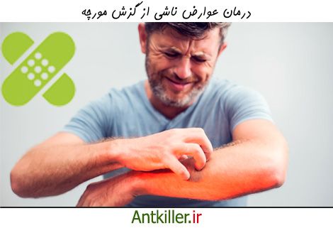 چگونه درد ناشی از گزش مورچه را درمان کنیم؟